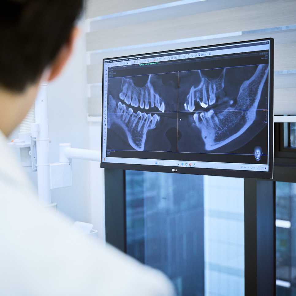 뼈이식 없이 임플란트 하면 안 되나요? 임플란트 뼈이식에 대해 하루플란트가 답해드립니다! 관련 이미지 5