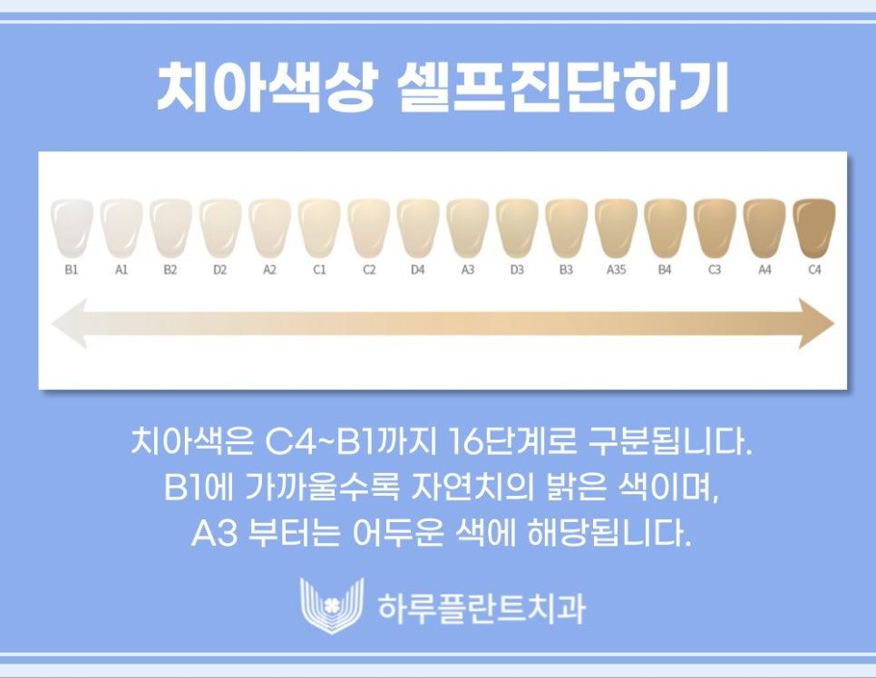 강남치과 하루플란트치과 치아미백 고민중이라면 관련 이미지 6