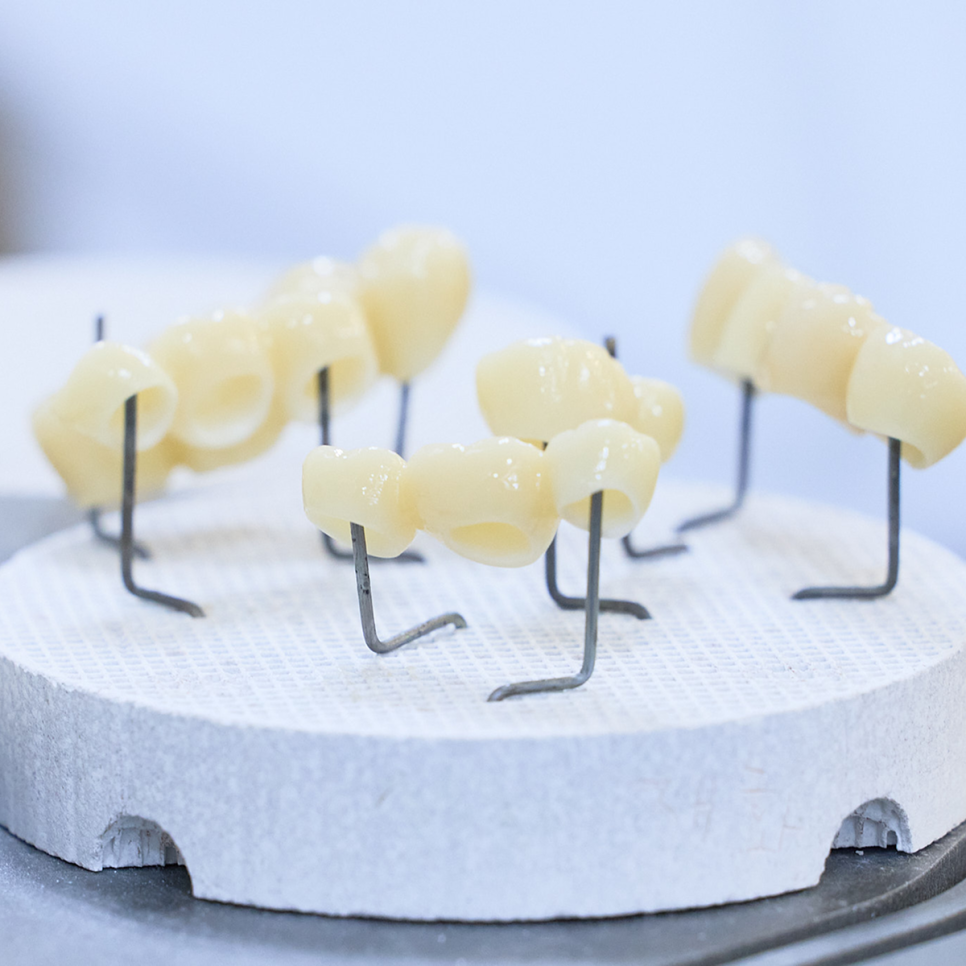 임플란트 수명, 왜 사람마다 다를까? 임플란트 수명을 더 끌어올리는 하루플라즈마에 주목하세요! 관련 이미지 2