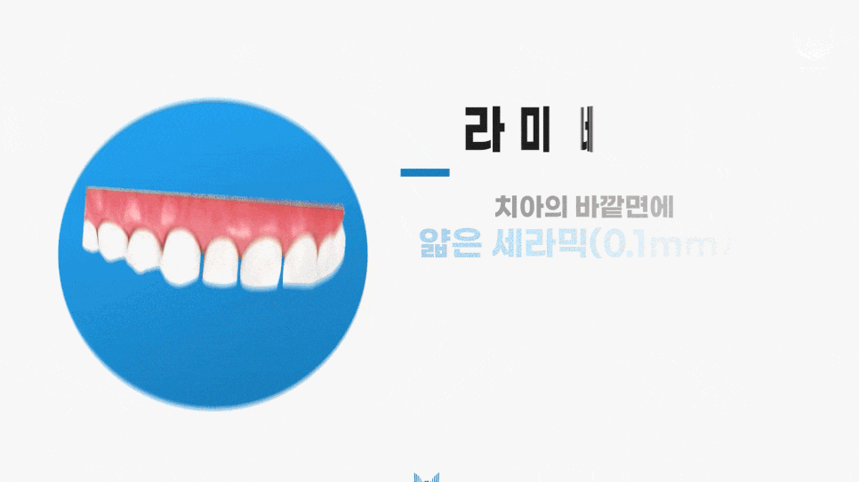 무삭제 라미네이트, 원데이 치료 관련 당부의 말씀 - 하루플란트치과 방문 전 필독 관련 이미지 3