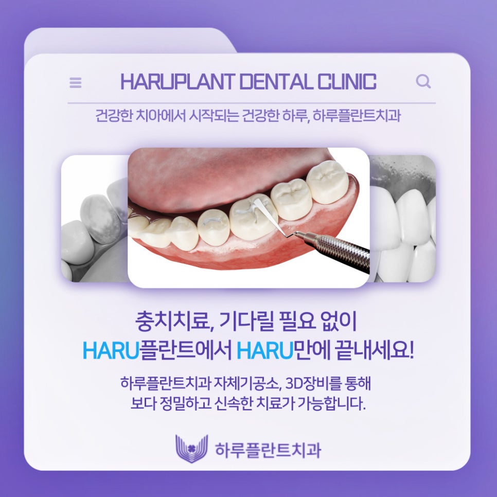 강남역치과 하루플란트치과 충치치료 미루고있다면 관련 이미지 8