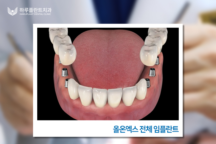 노인 틀니 가격? 관련 이미지 7