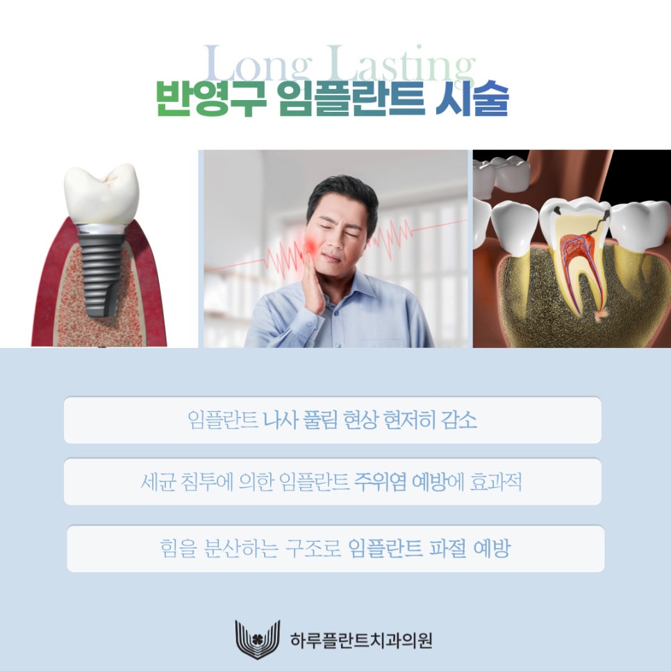 통증 줄이고 회복 빠른 하루플란트치과 CLS 무절개 임플란트 관련 이미지 4