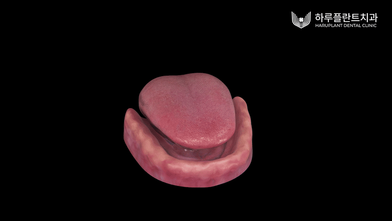 전체 틀니 가격보다 중요한 관련 이미지 5