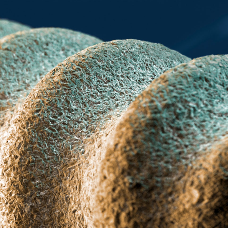 임플란트 걱정하는 당뇨 환자라면? OOOO 임플란트가 답이다! 관련 이미지 5