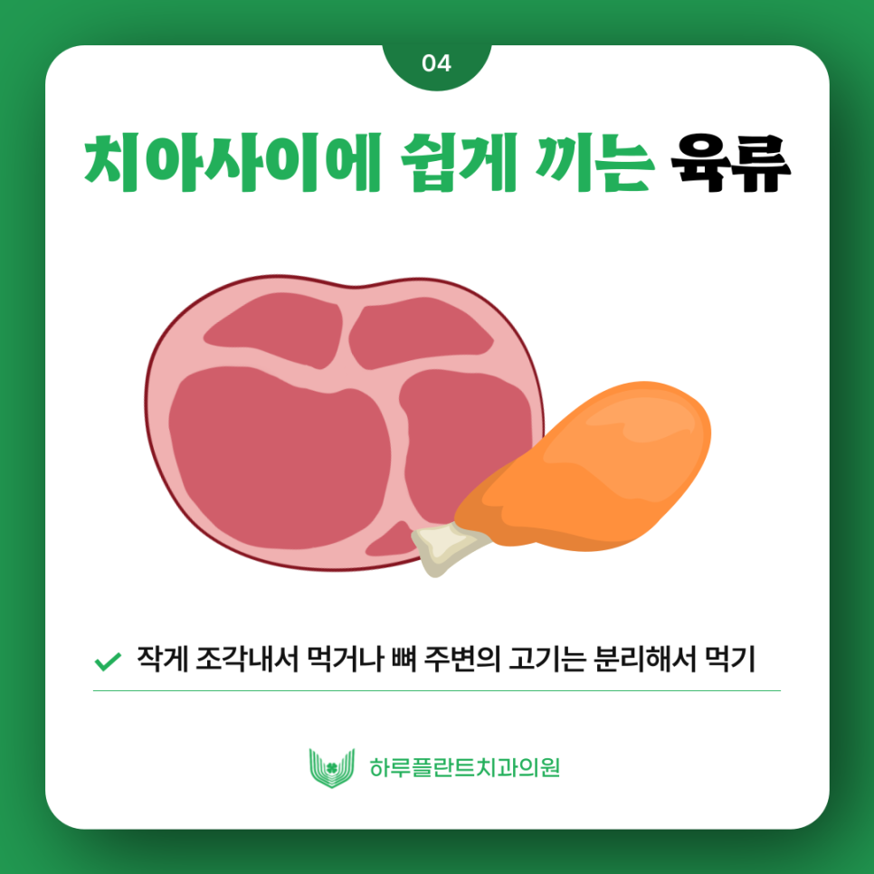 [HARU치과상식] 치아교정시 피해야하는 음식은? 관련 이미지 5