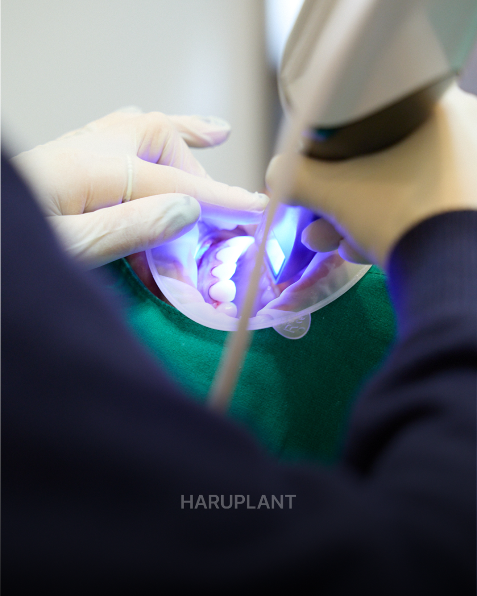 Why All-on-X Implants May Be Worth Considering Even If You Have Been Told That Full-Arch Implants Are Difficult image 11