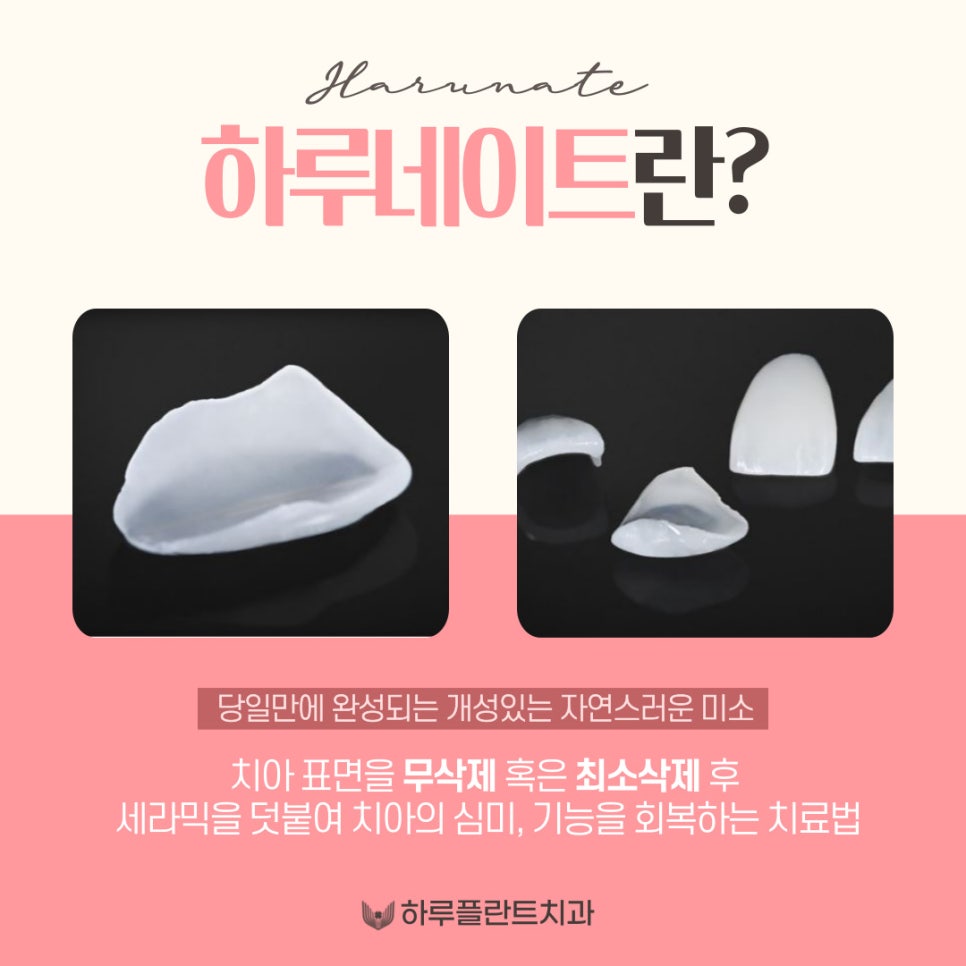 강남역 하루플란트치과 당일 완성 라미네이트 <하루네이트> 관련 이미지 2