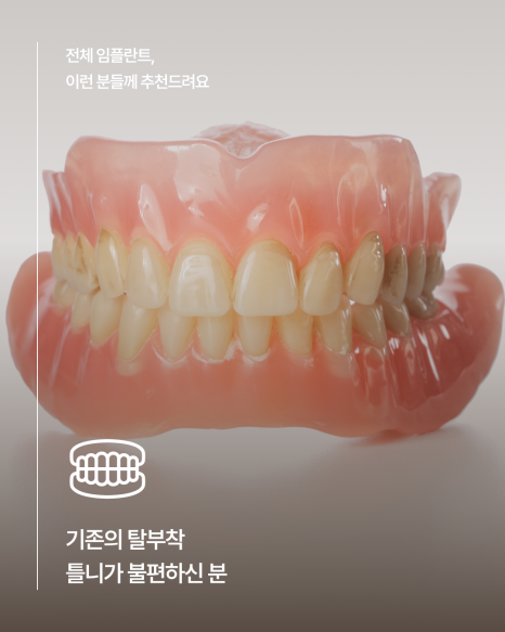 65세이상임플란트 중 무치악에 해당한다면, 전체임플란트가 필요한지 먼저 확인하세요! 관련 이미지 3