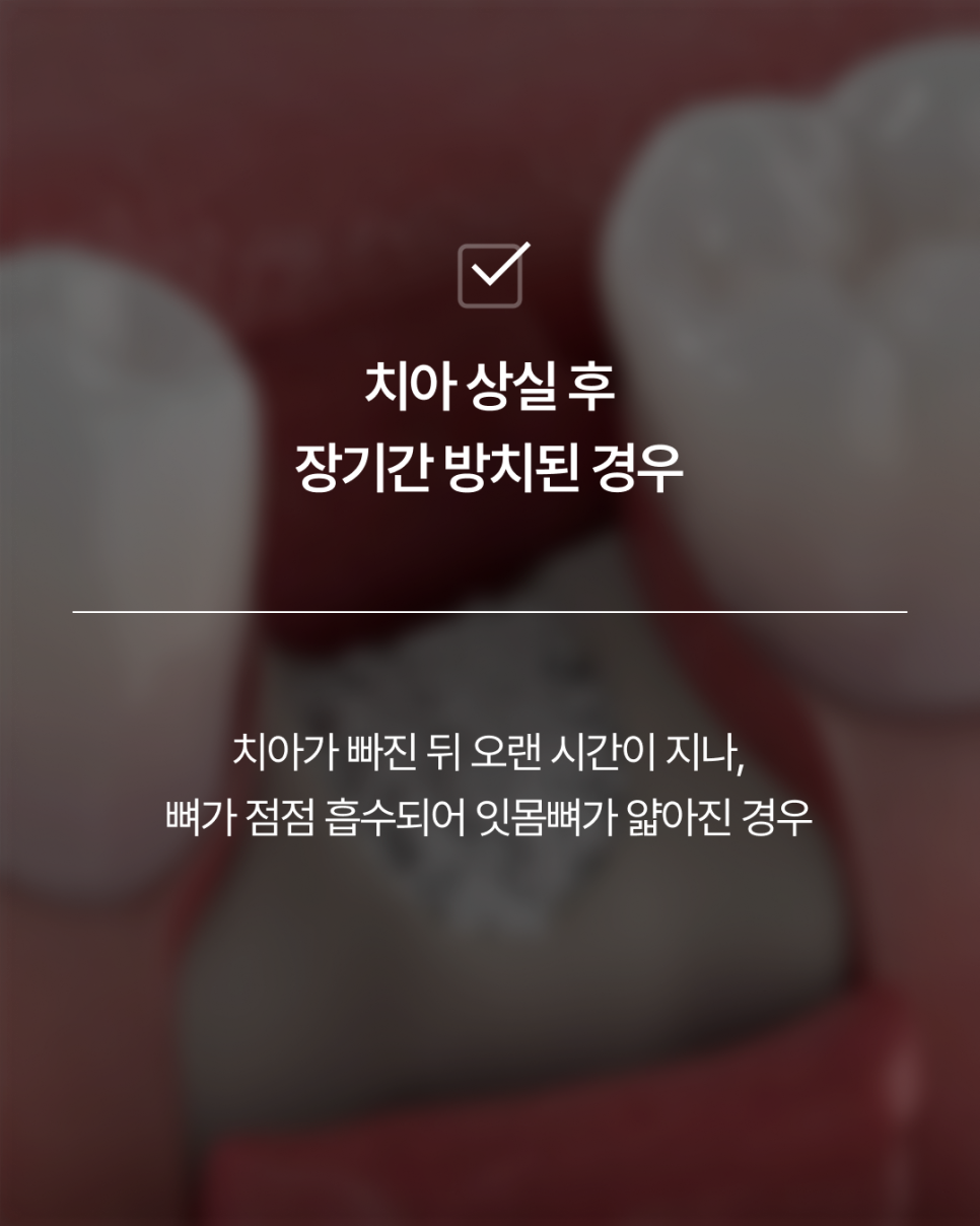 임플란트뼈이식, 반드시 필요할까요? 강남임플란트 하루플란트에서 기준을 확인하세요 관련 이미지 5