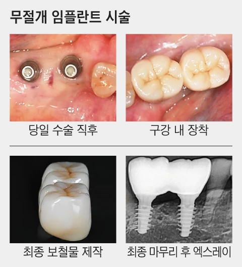강남역치과 언론이 주목하는 하루플란트치과 변성만 대표원장 관련 이미지 10