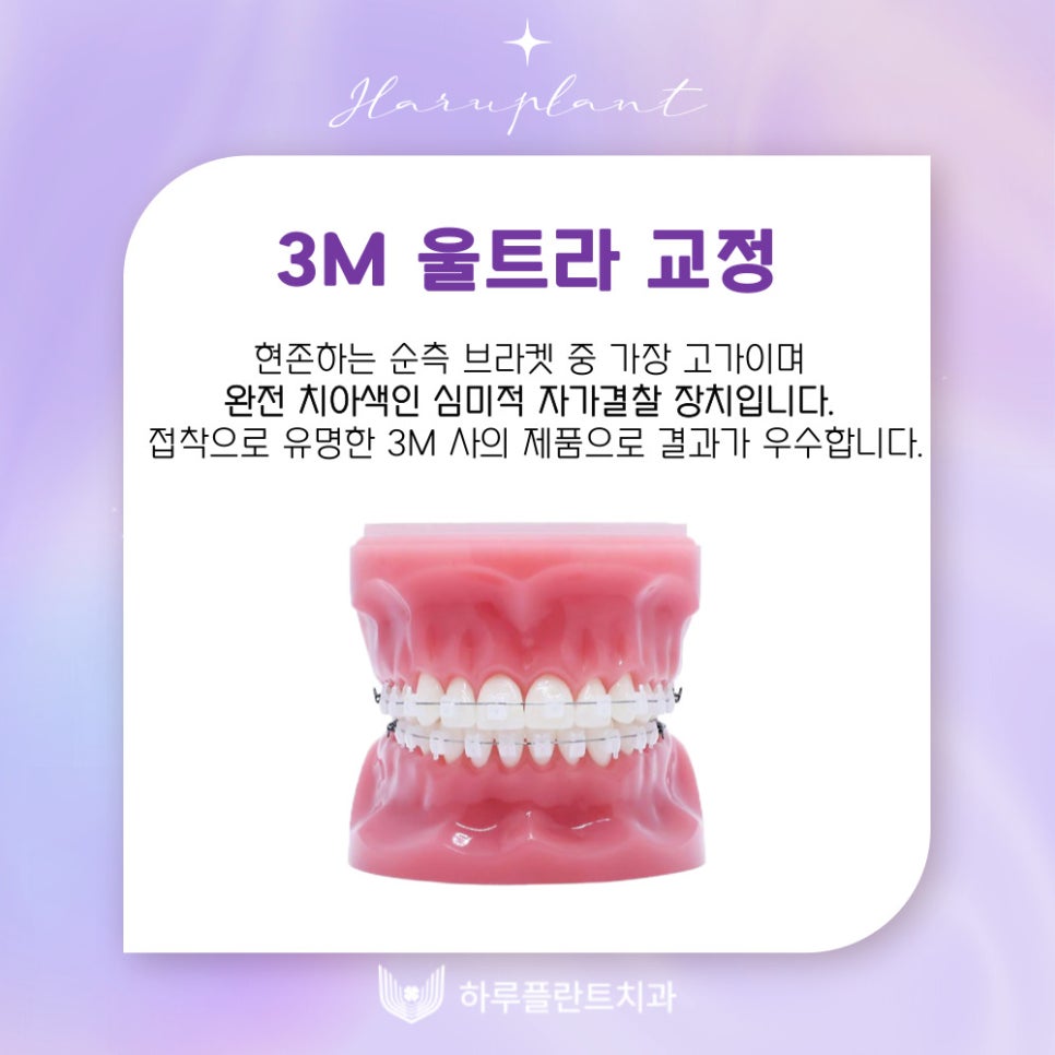 강남역치과 하루플란트치과 치아교정 개인별 맞춤 교정으로 관련 이미지 4