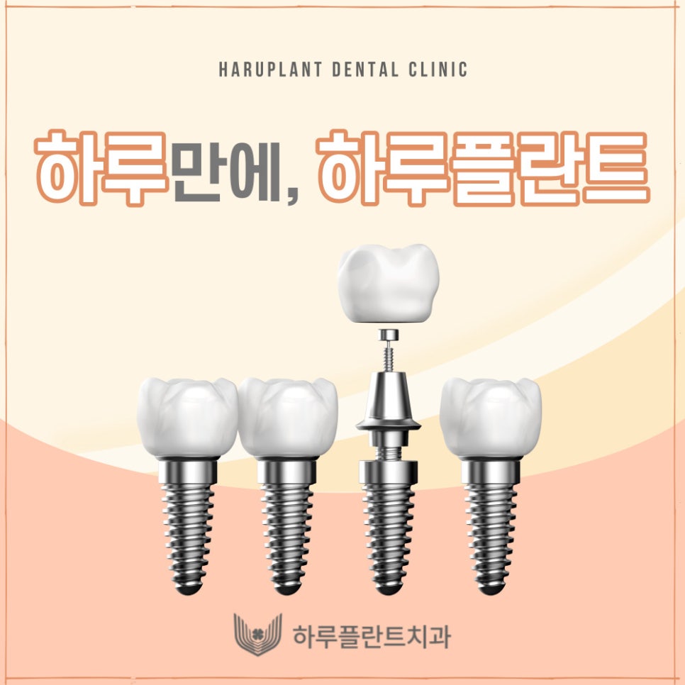 하루플란트치과 변성만 대표원장 타치과 임플란트 불가판정 성공사례 관련 이미지 2
