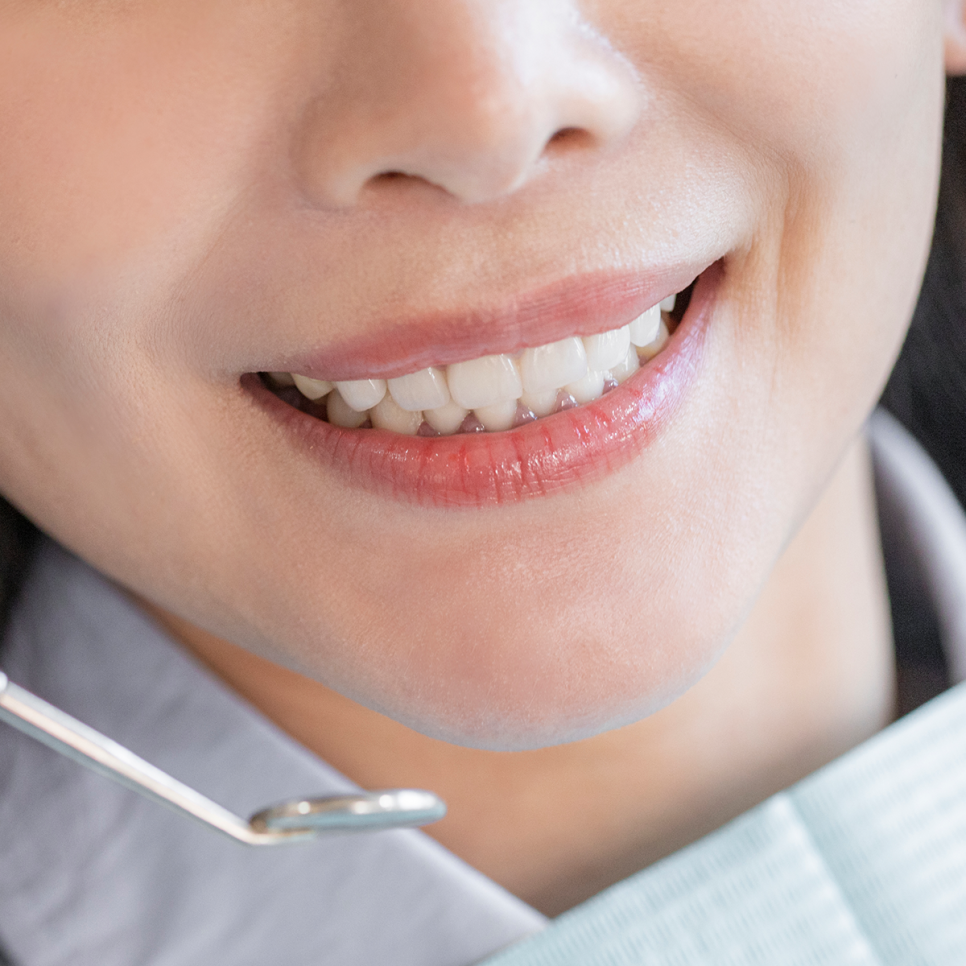 앞니 임플란트 고민 중이라면? 하루플란트와 함께 체크해야 할 사항, 세 가지 알아보기 관련 이미지 1