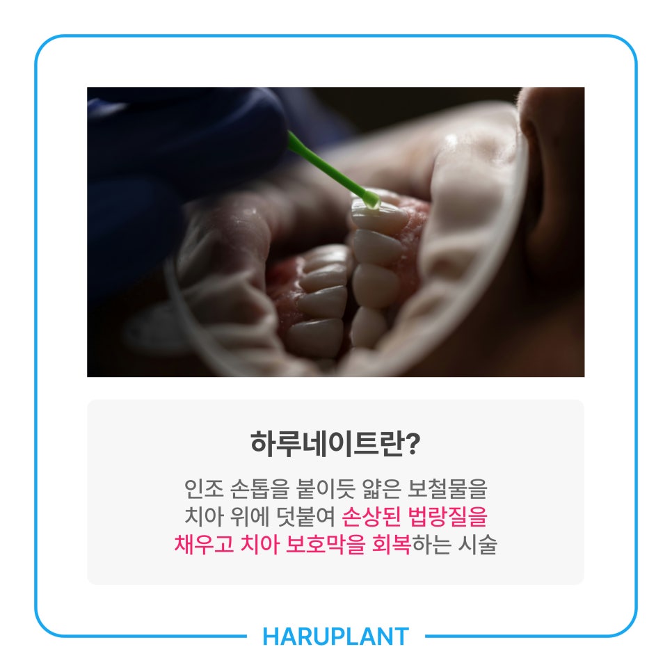 이 시린 이유, 시린 이 치료법 하루네이트로 회복하세요 관련 이미지 4