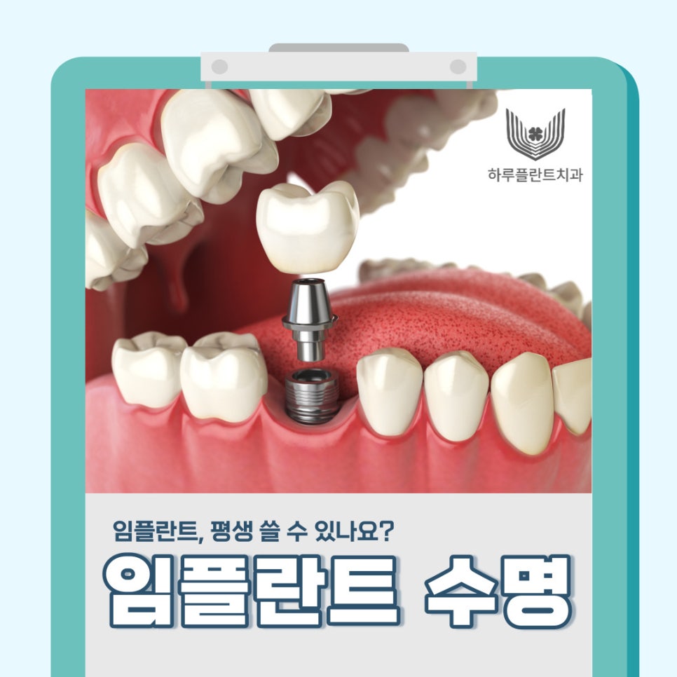 임플란트 평생 쓸 수 있나요? 오래 쓰는 방법 대공개(무절개 임플란트 수명) 관련 이미지 1