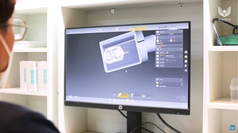 서초구임플란트 자체 기공소 있는 곳에서 해야 하는 이유 관련 이미지 5