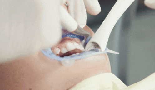 강남역스케일링 통증,시림 없는 프리미엄 에어플로우 스케일링 관련 이미지 14