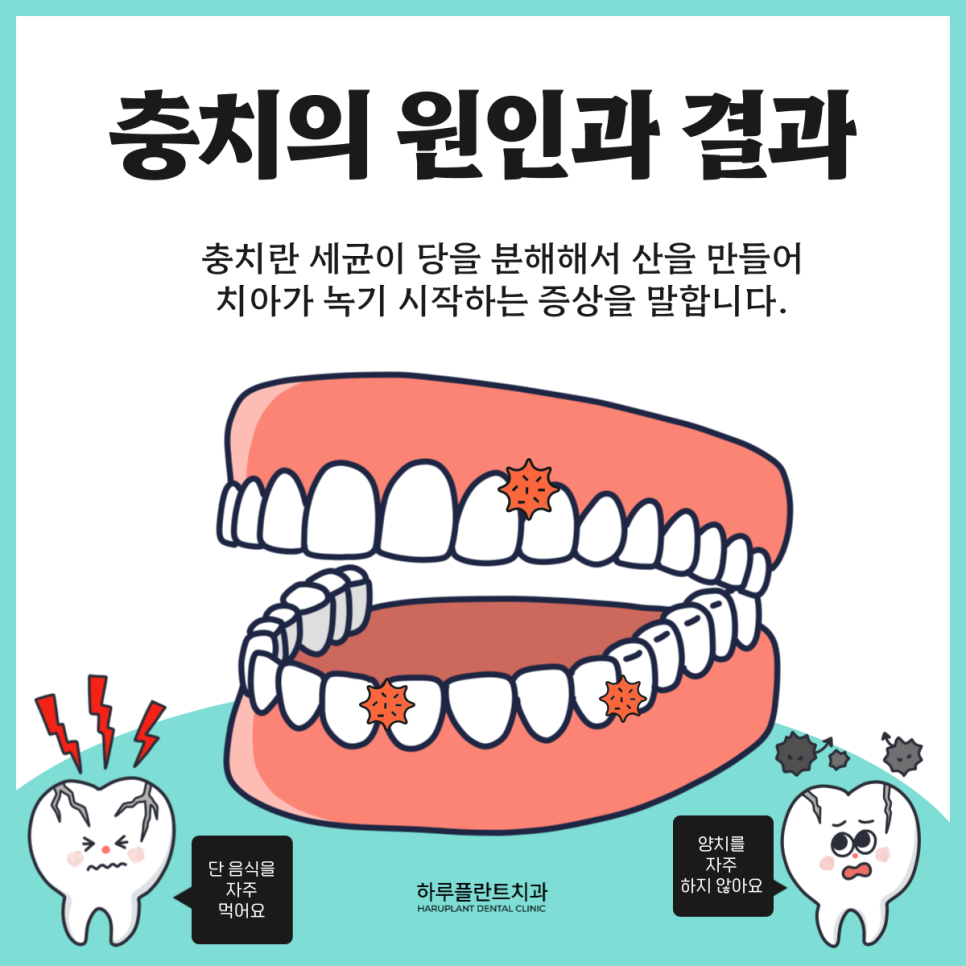 [HARU치과상식] 치아관리로 건강하게 치아지키기 관련 이미지 3