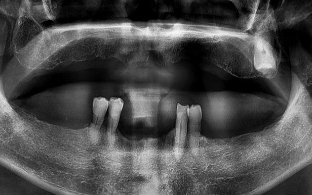 강남역치과 언론이 주목하는 하루플란트치과 변성만 대표원장 관련 이미지 7