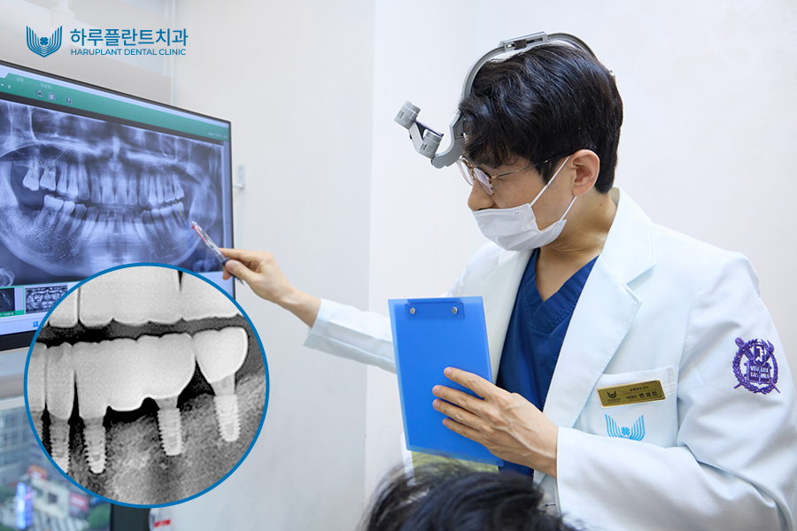 완전틀니가격? 임플란트보다 틀니가 비싼 이유 관련 이미지 4