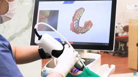 서초구임플란트 자체 기공소 있는 곳에서 해야 하는 이유 관련 이미지 4