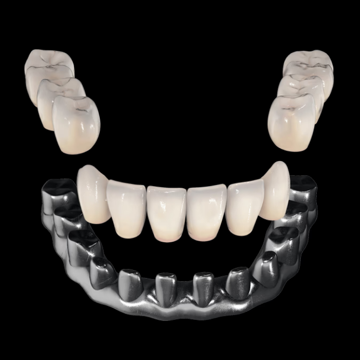 전체 임플란트가 부담된다면 이건 어떠세요? 하루플란트의 실속있는 올온엑스 임플란트 솔루션! 관련 이미지 7