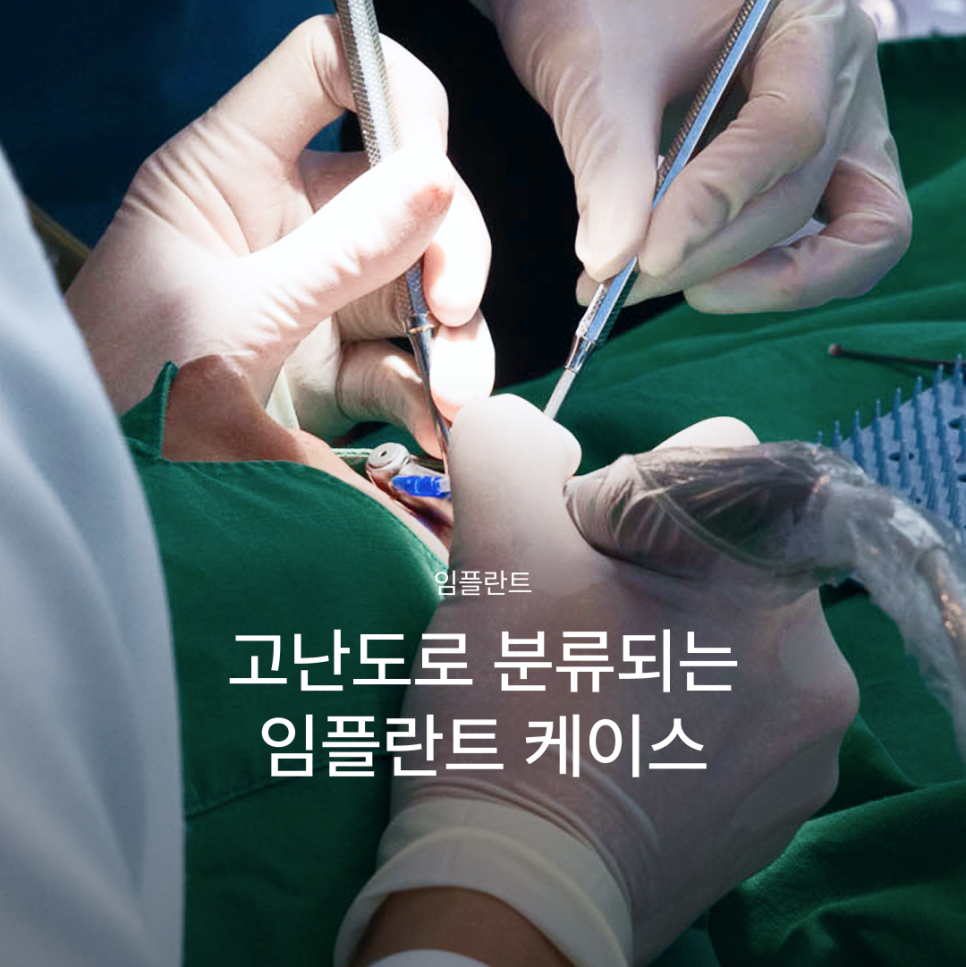 나도 고난도 임플란트 케이스일까? 상악동거상술부터 재수술까지 고난도임플란트종류 알아보기 관련 이미지 1