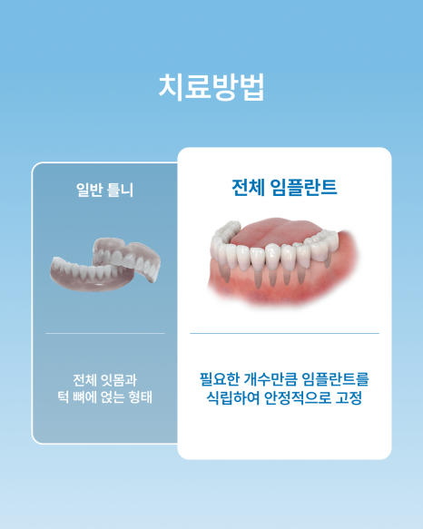 If Dentures Are Uncomfortable, What You Need to Know: The Differences Between Full-Arch Implants and Dentures, as Explained by Haru Plant Dental Clinic in Gangnam image 2