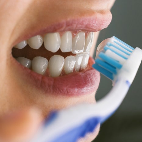 치아 사이 틈, 하루네이트로 해결할 수 있습니다 관련 이미지 11