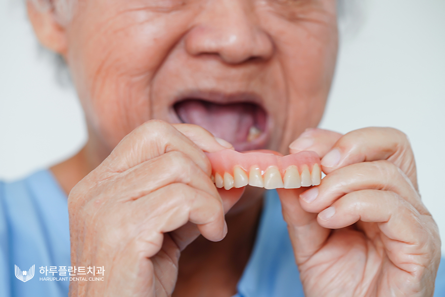 완전틀니가격? 임플란트보다 틀니가 비싼 이유 관련 이미지 3