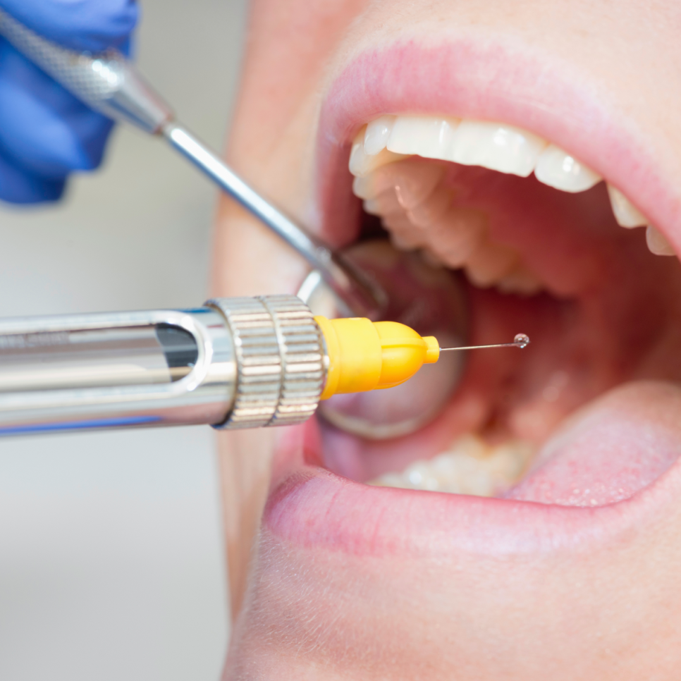 임플란트 통증 줄이는 방법? 하루플란트에서는 이렇게 마취하고 있습니다! 관련 이미지 6