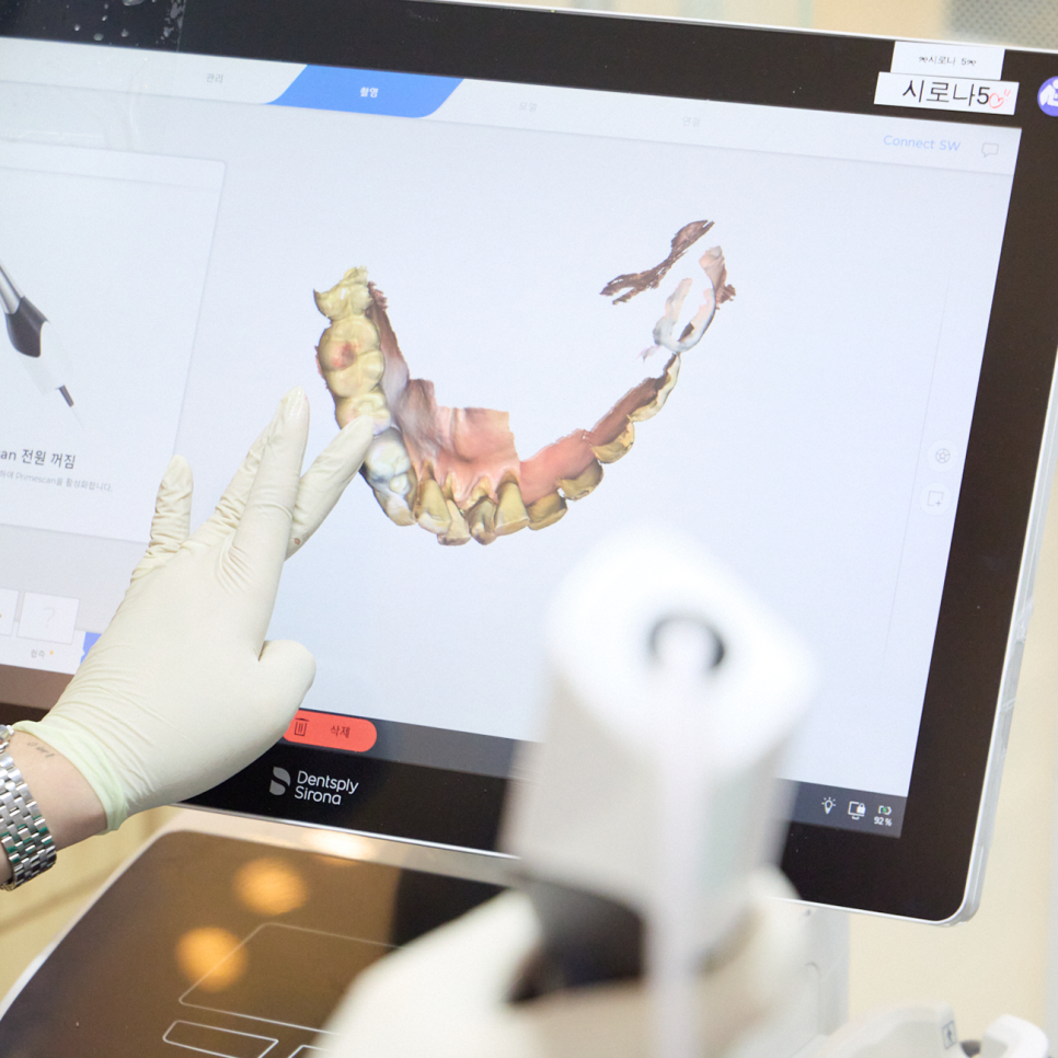 진짜 내 치아 같은 임플란트? 자연스러운 모양으로 심미성까지 살려낸 하루플란트의 선택 관련 이미지 5