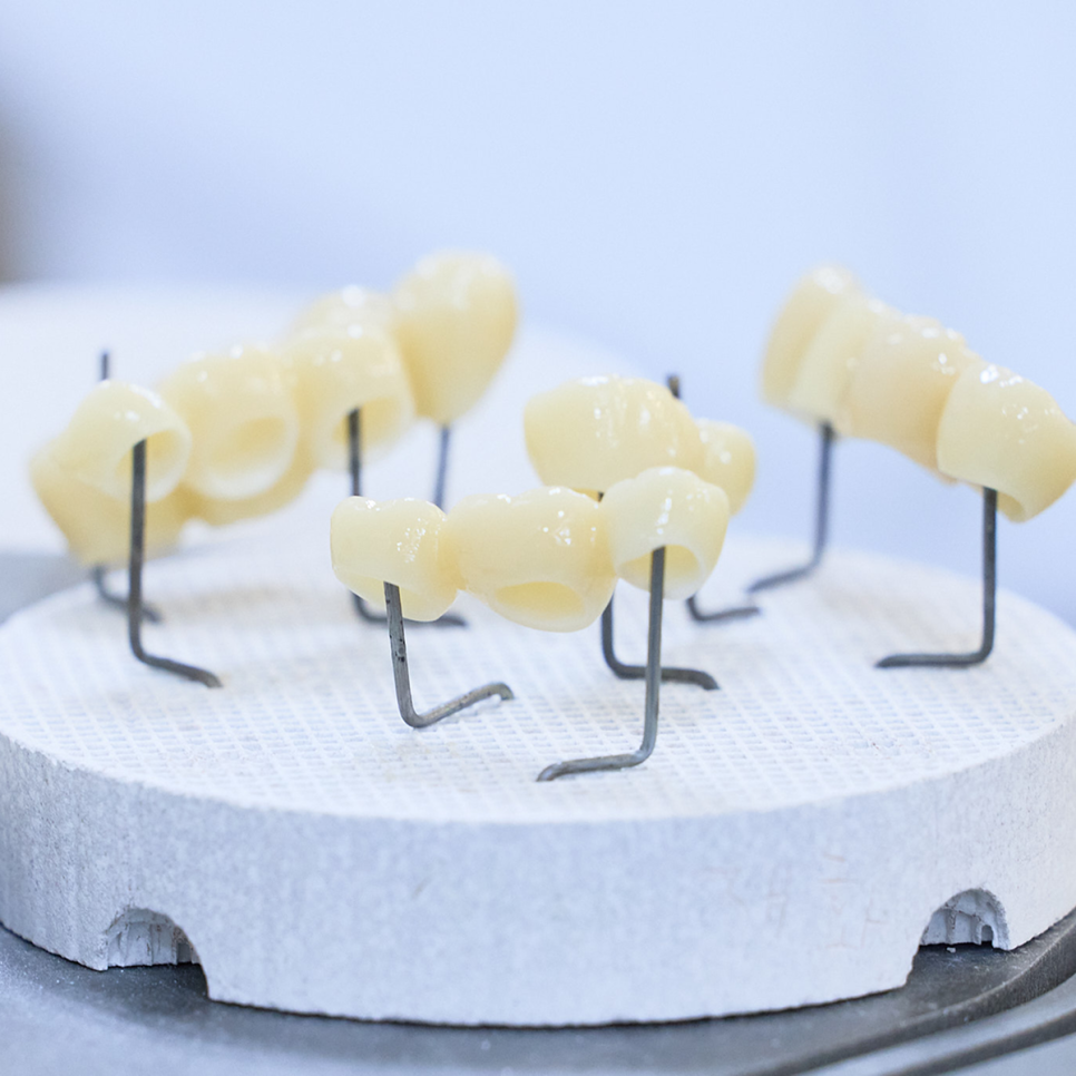 임플란트 하면 충치 걱정 끝? 임플란트 관리, 충치보다 진짜 중요한 건 따로 있어요! 관련 이미지 2