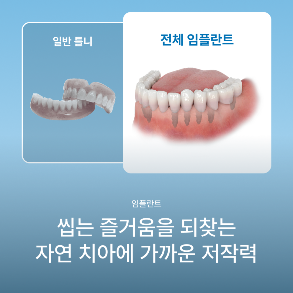 If Dentures Are Uncomfortable, What You Need to Know: The Differences Between Full-Arch Implants and Dentures, as Explained by Haru Plant Dental Clinic in Gangnam image 1