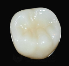 치과당일치료 하루플란트치과의 혁신적인 하루완성 클리닉 관련 이미지 17