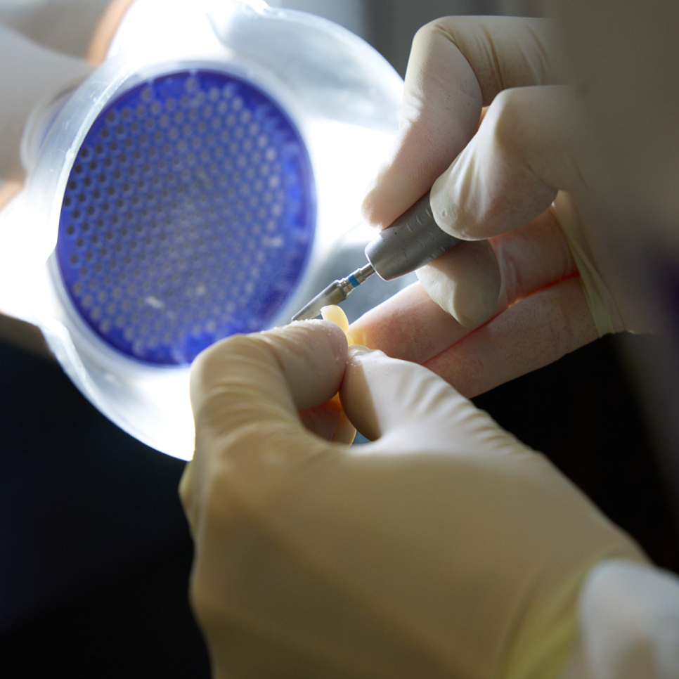 진짜 내 치아 같은 임플란트? 자연스러운 모양으로 심미성까지 살려낸 하루플란트의 선택 관련 이미지 7