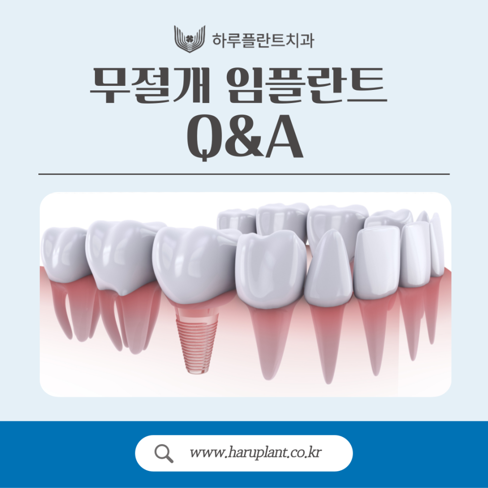 무절개 임플란트 수술 과정, 장점, 부작용까지 관련 이미지 1