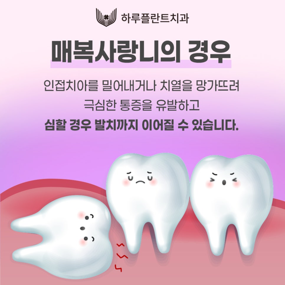 강남 하루플란트치과 사랑니발치, 사랑니 꼭 뽑아야할까요? 관련 이미지 7