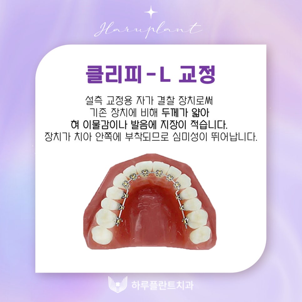 강남역치과 하루플란트치과 치아교정 개인별 맞춤 교정으로 관련 이미지 8