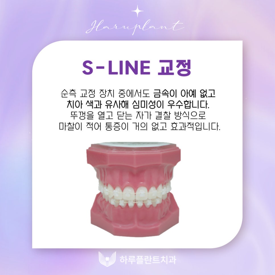 강남역치과 하루플란트치과 치아교정 개인별 맞춤 교정으로 관련 이미지 6