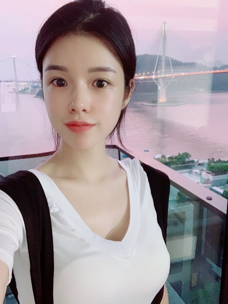 눈매교정술 또렷한 라인을 위해 관련 이미지 7
