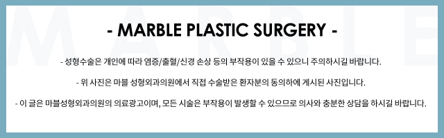 앞트임복원 왜 필요하고 어떻게 진행될까요? 관련 이미지 6