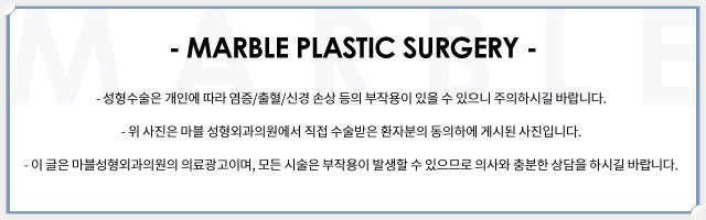 자연유착쌍꺼풀후기 눈매를 더욱 또렷하게 관련 이미지 19