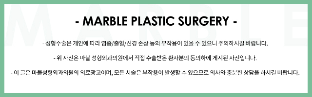 강남눈밑지방재배치 눈매를 위한 완벽 가이드 관련 이미지 7