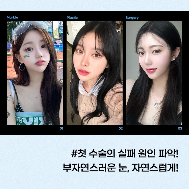 눈재수술잘하는곳 새로운 시작을 위해 관련 이미지 4