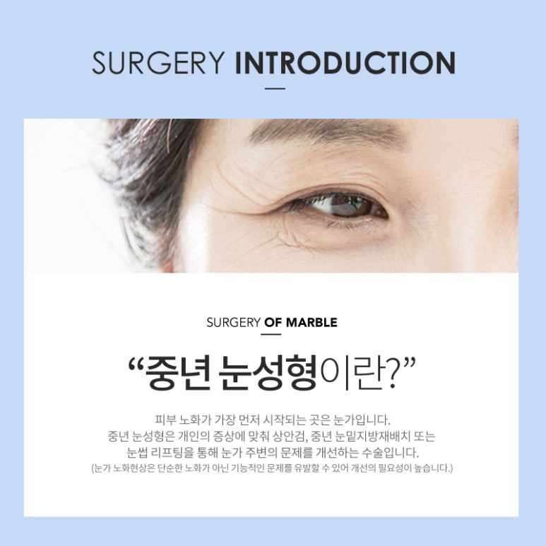중년눈성형 본인에게 맞는 방법으로 해야 관련 이미지 5