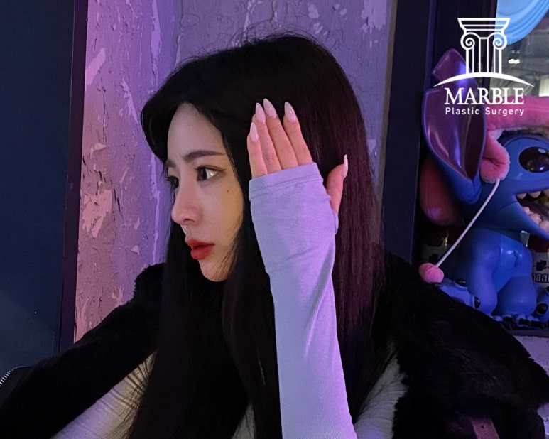 듀얼트임, 자연스럽게 예뻐지는 방법! 마블성형외과의원 관련 이미지 8