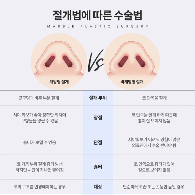 매부리코성형비용 후기까지 살펴보고 관련 이미지 7