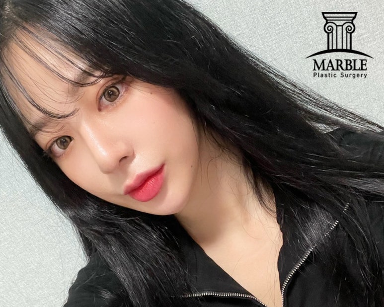 듀얼트임, 자연스럽게 예뻐지는 방법! 마블성형외과의원 관련 이미지 6